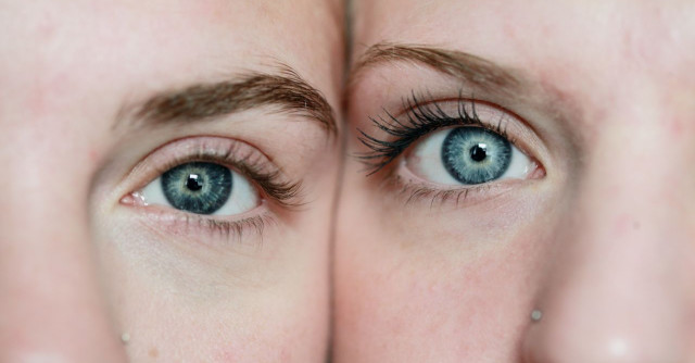 does medicare pay for cataract surgery